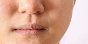 serum untuk kulit kering