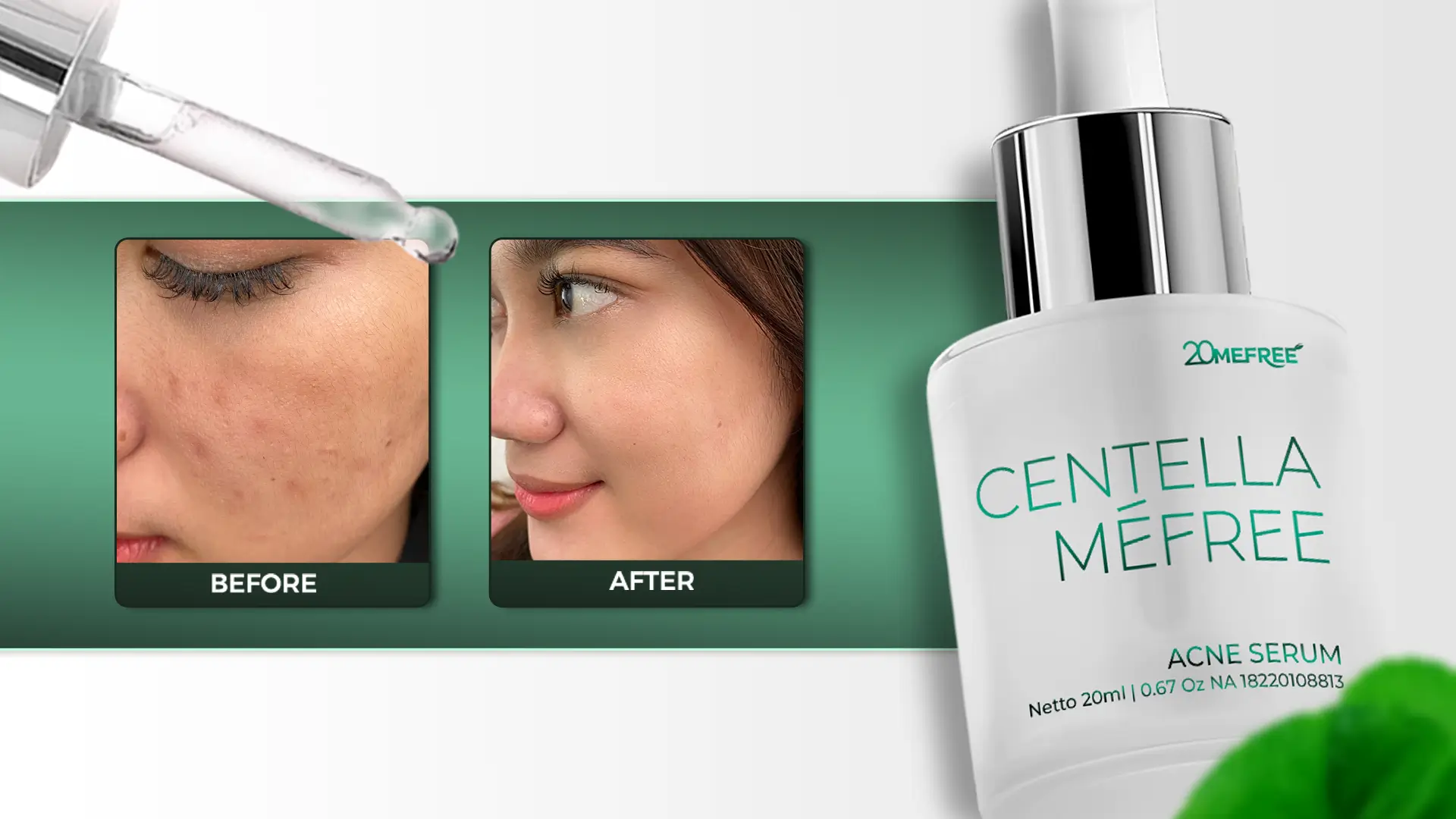 salicylic-acid-kandungan-penting-serum-centella-20mefree