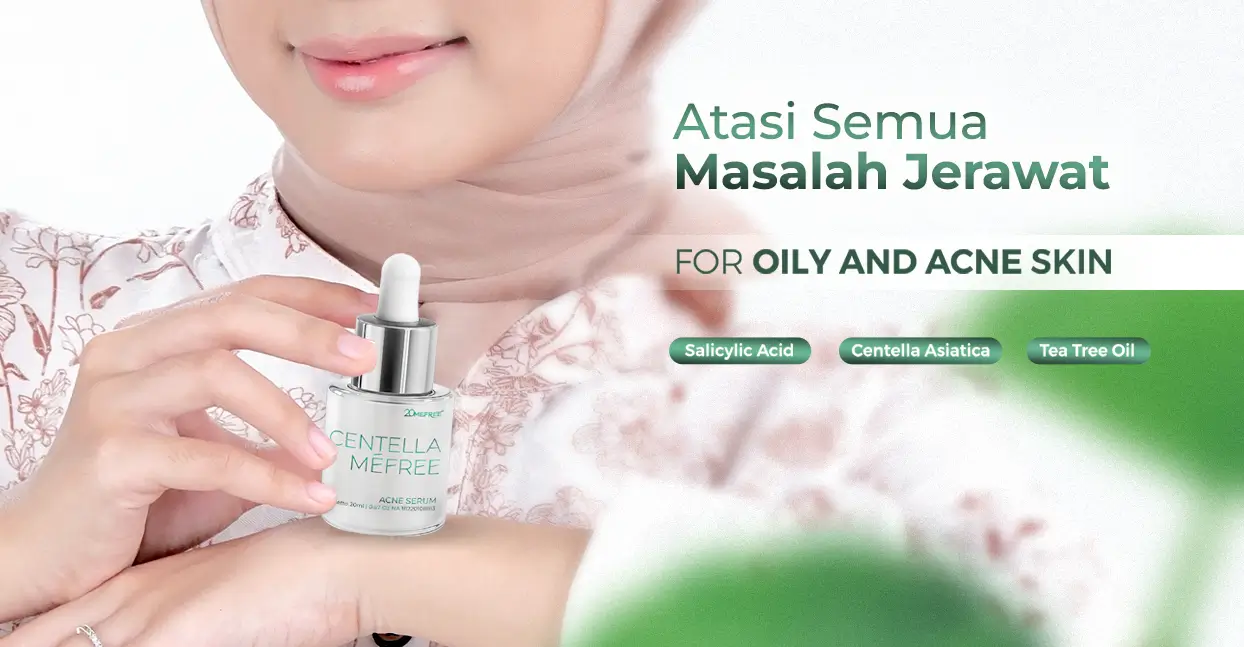 penyebab-flek-hitam-karena-jerawat-mengganggu-penampilanmu-segera-gunakan-serum-acne-20mefree