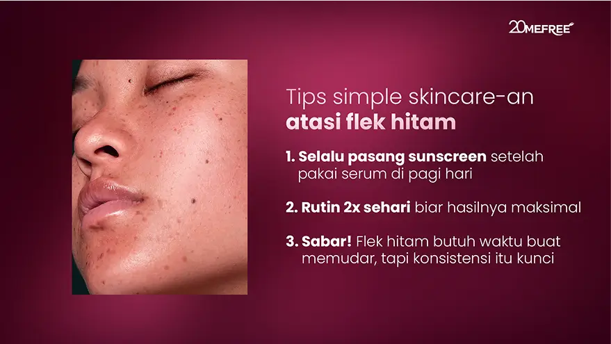 tips-simpel-skincarean-atasi-flek-hitam