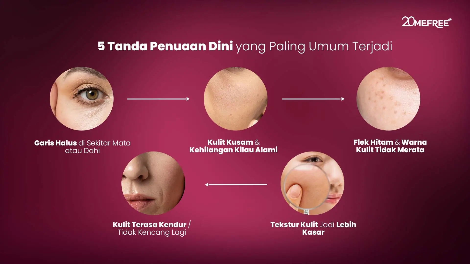 5-tanda-penuaan-dini-yang-paling-umum-terjadi