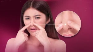 cara-efektif-atasi-pori-pori-besar-di-hidung