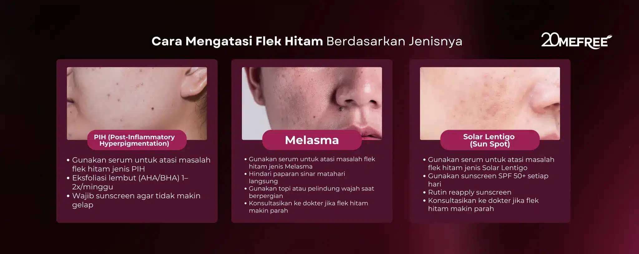 cara-mengatasi-flek-hitam-berdasarka-jenisnya