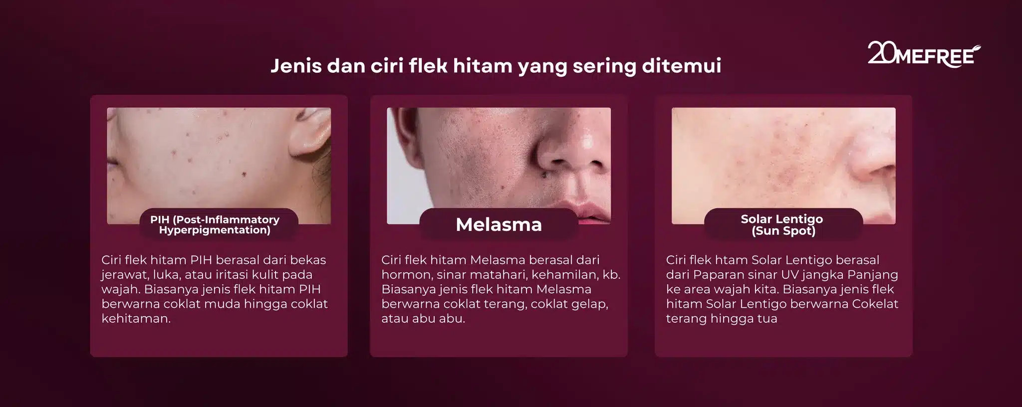 jenis-dan-ciri-flek-hitam-yang-sering-ditemui