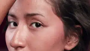 kenali-dampak-dan-cara-mengatasi-pori-pori-besar