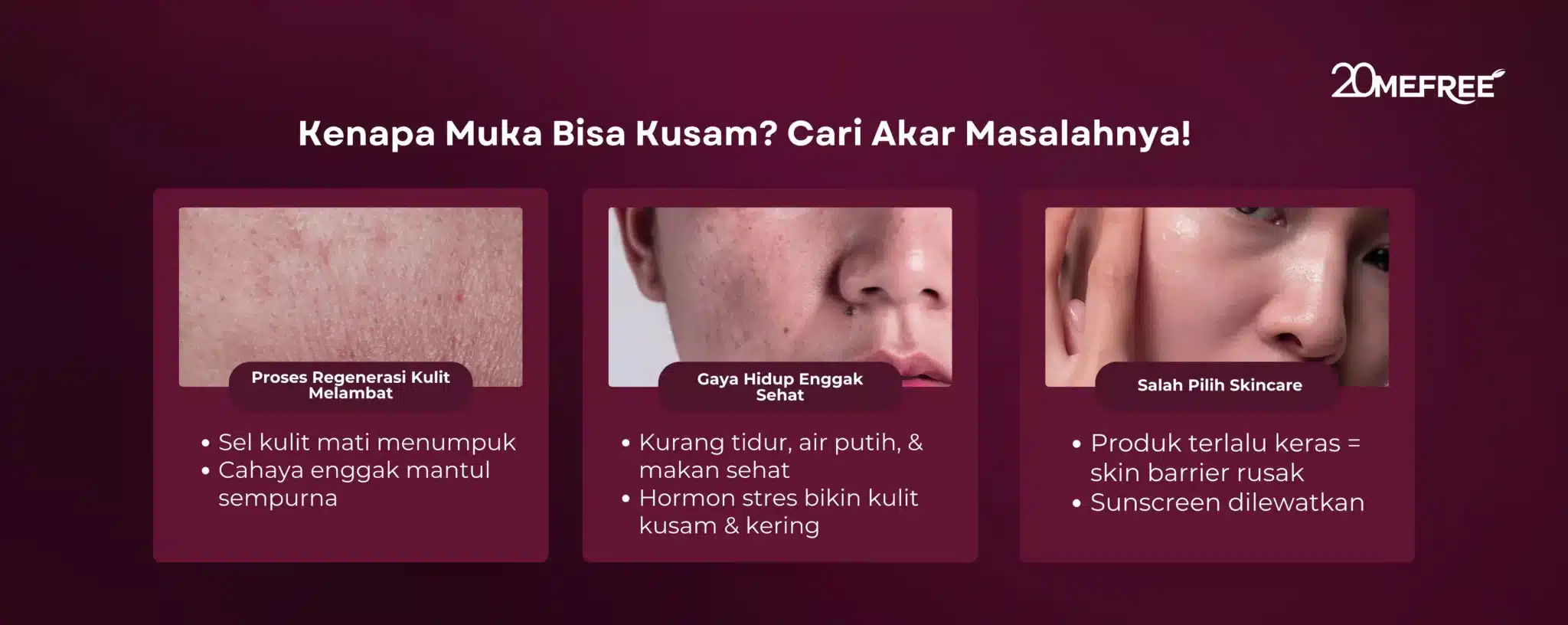 kenapa-muka-bisa-kusam-cari-akar-masalahnya