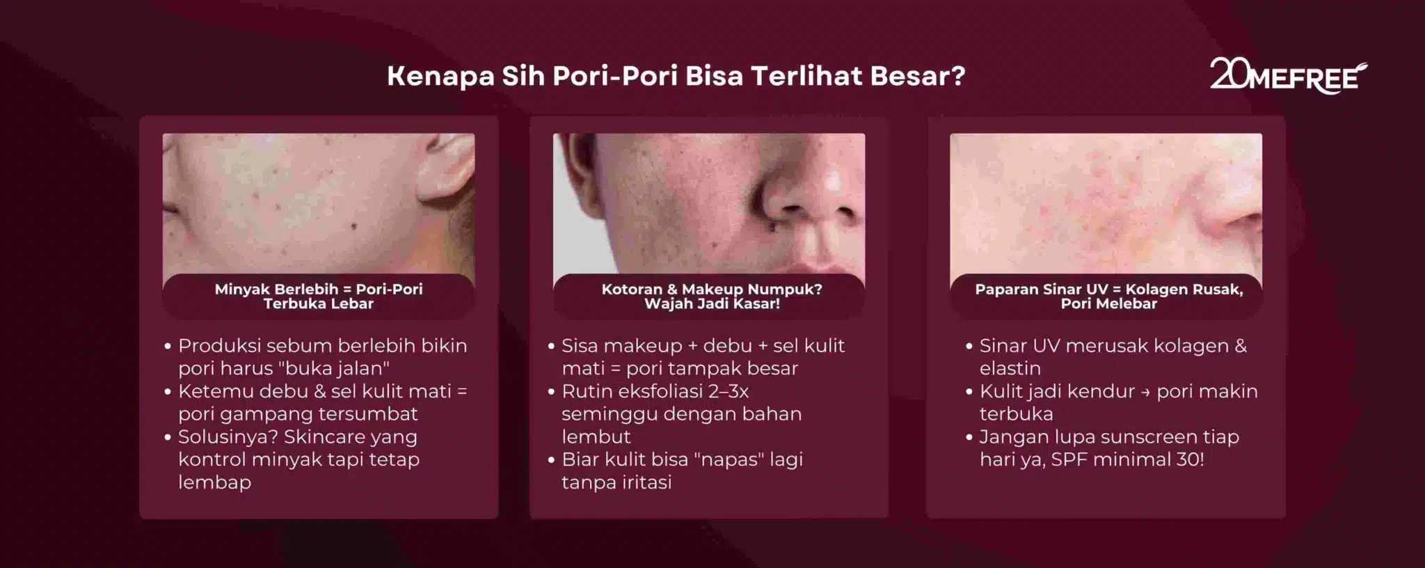 kenapa-sih-pori-pori-bisa-terlihat-besar