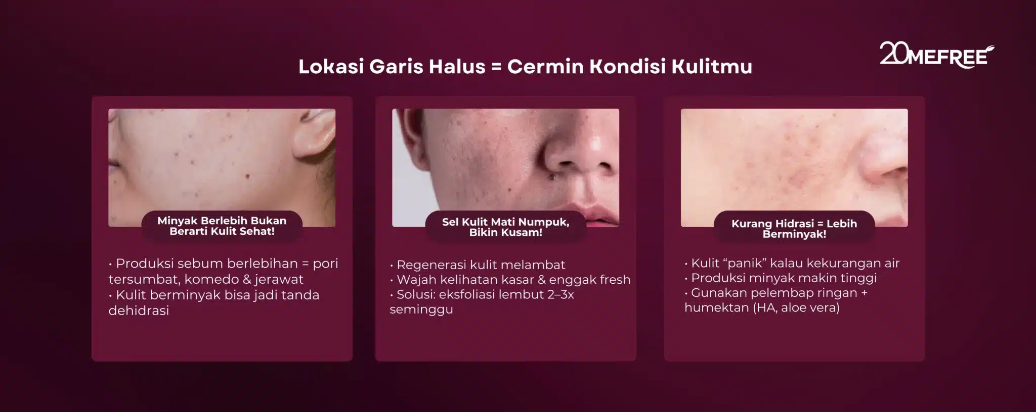 lokasi-garis-halus-cermin-kondisi-kulitmu
