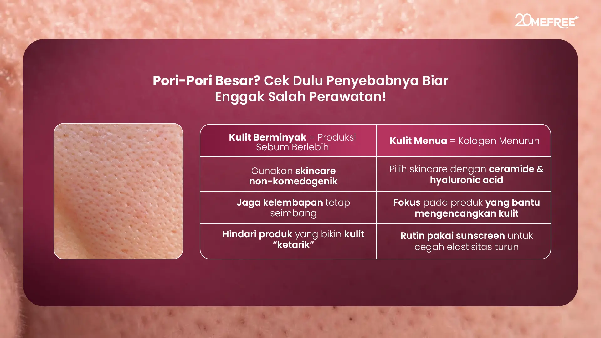 pori-pori-besar-cek-dulu-penyebabnya-biar-enggak-salah-perawatan