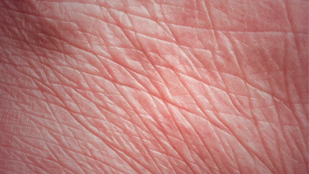 tips-atasi-garis-garis-halus-di-wajah