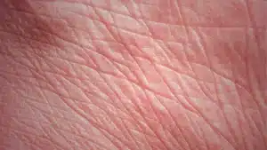 tips-atasi-garis-garis-halus-di-wajah