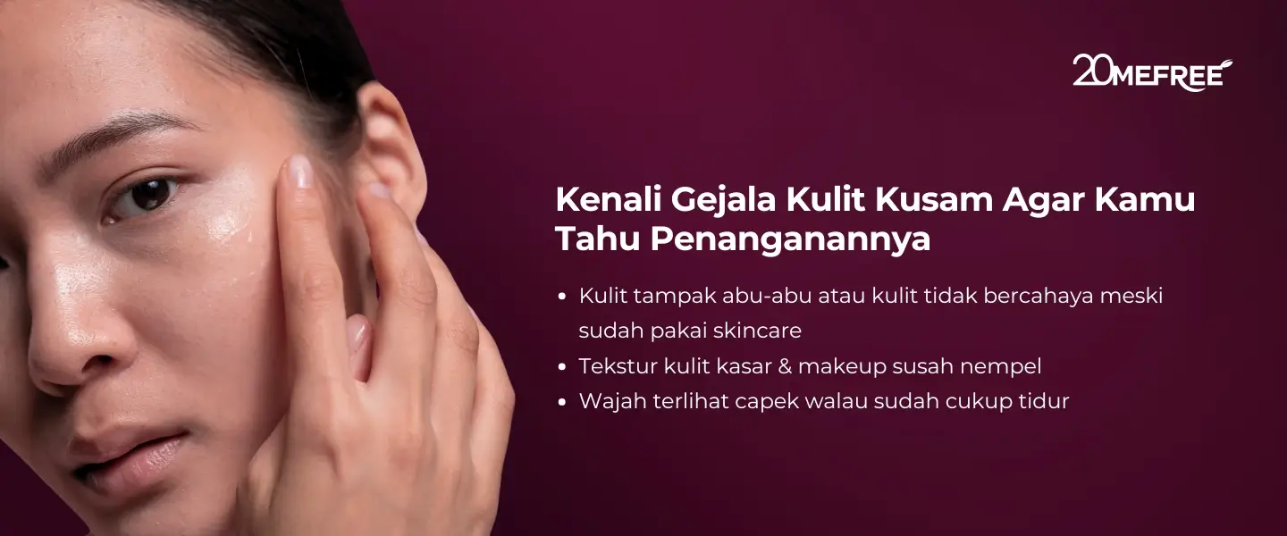 kenali-gejala-kulit-kusam-agar-kamu-tahu-penanganannya