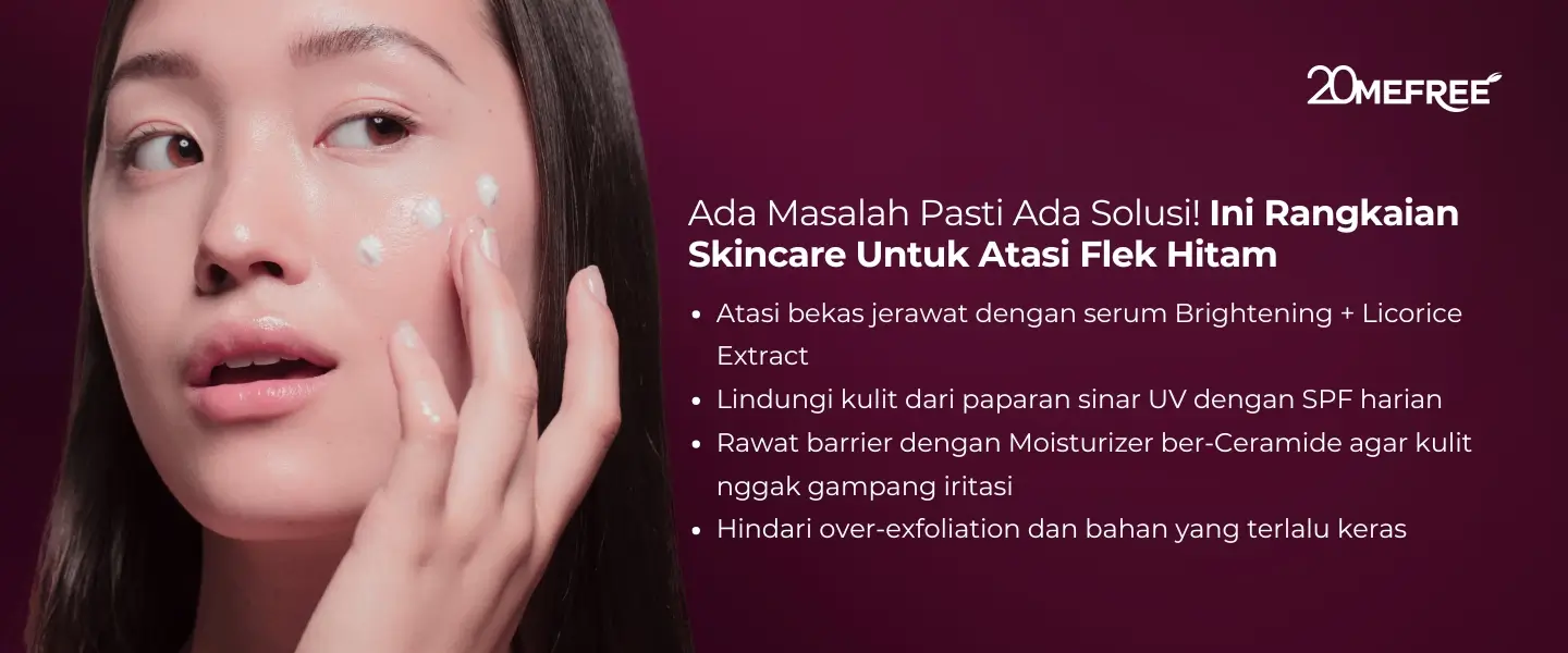 ada-masalah-pasti-ada-solusinya-ini-rangkaian-skincare-untuk-atasi-flek-hitam