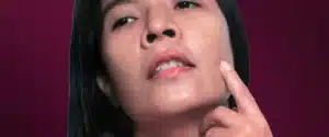 Atasi Garis Halus di Wajah dengan Efektif