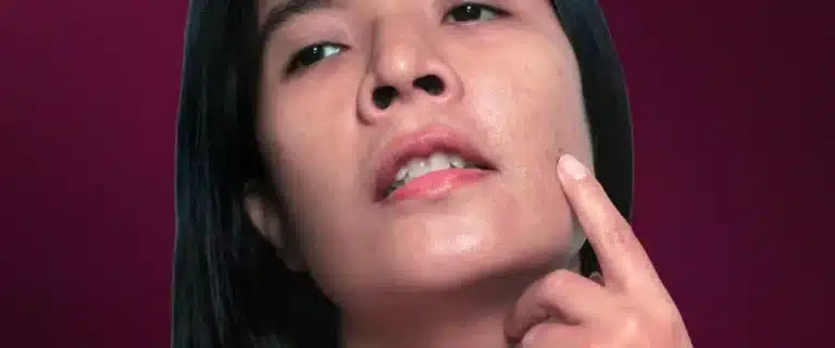 Atasi Garis Halus di Wajah dengan Efektif