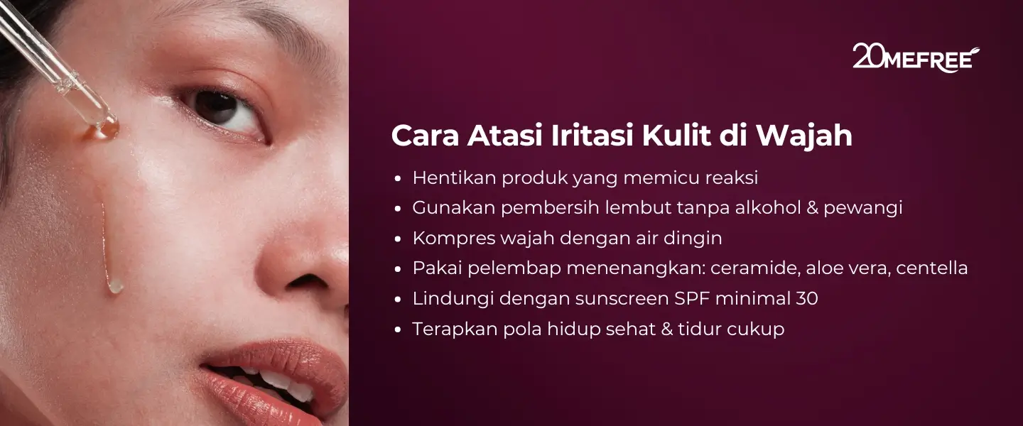 Cara Atasi Iritasi Kulit di Wajah