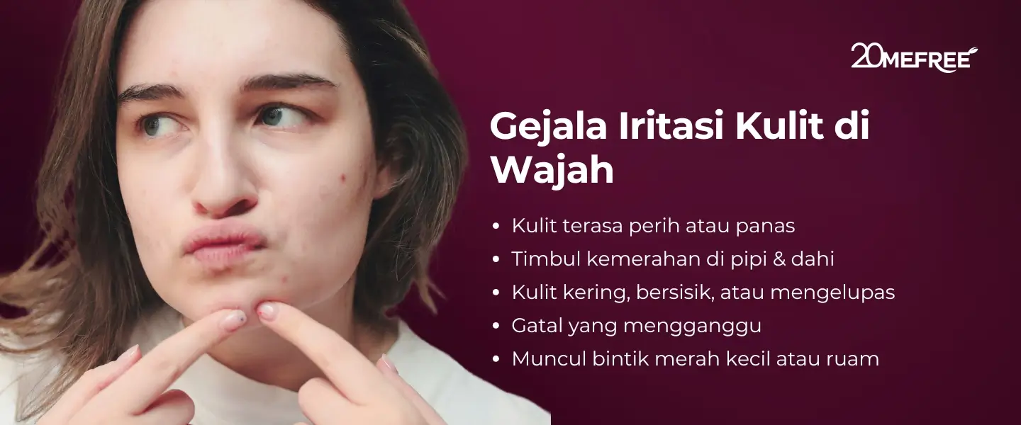 Gejala Iritasi Kulit di Wajah