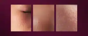 kenali-penyebab-agar-muka-tidak-kusam
