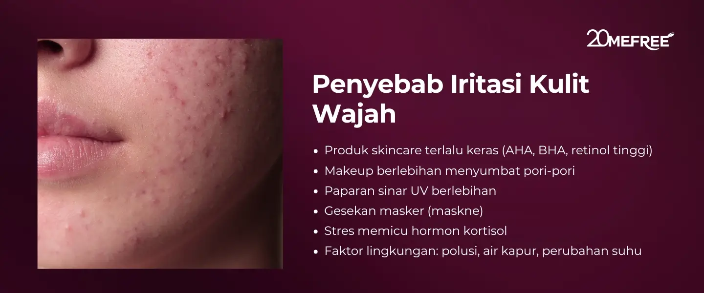 Penhyebab Iritasi Kulit Wajah