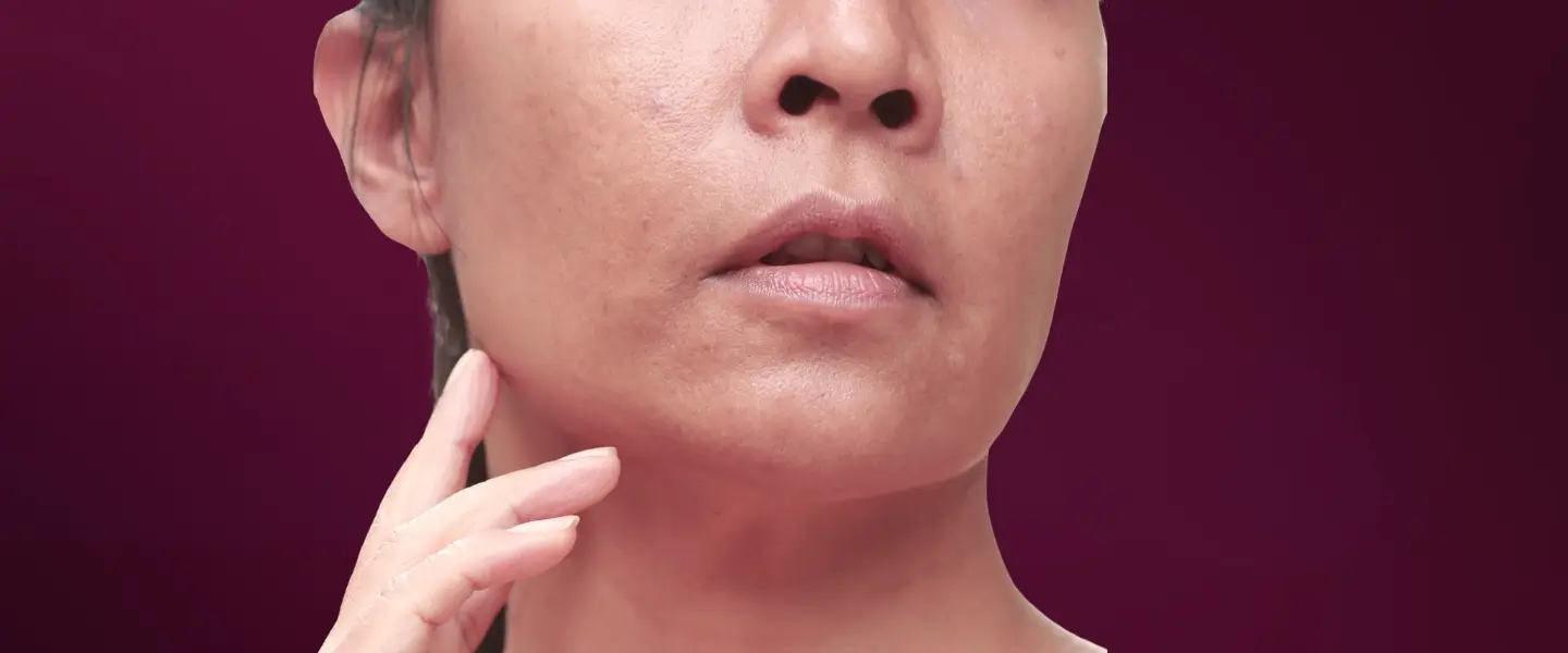 Fakta Menarik di Balik Penyebab Kulit Kering