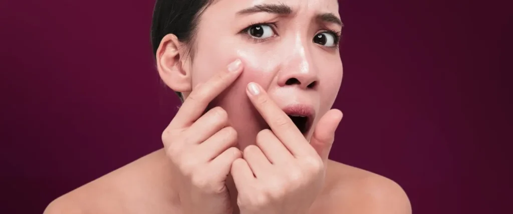 Kulit kering di wajah membuat kita kurang percaya diri