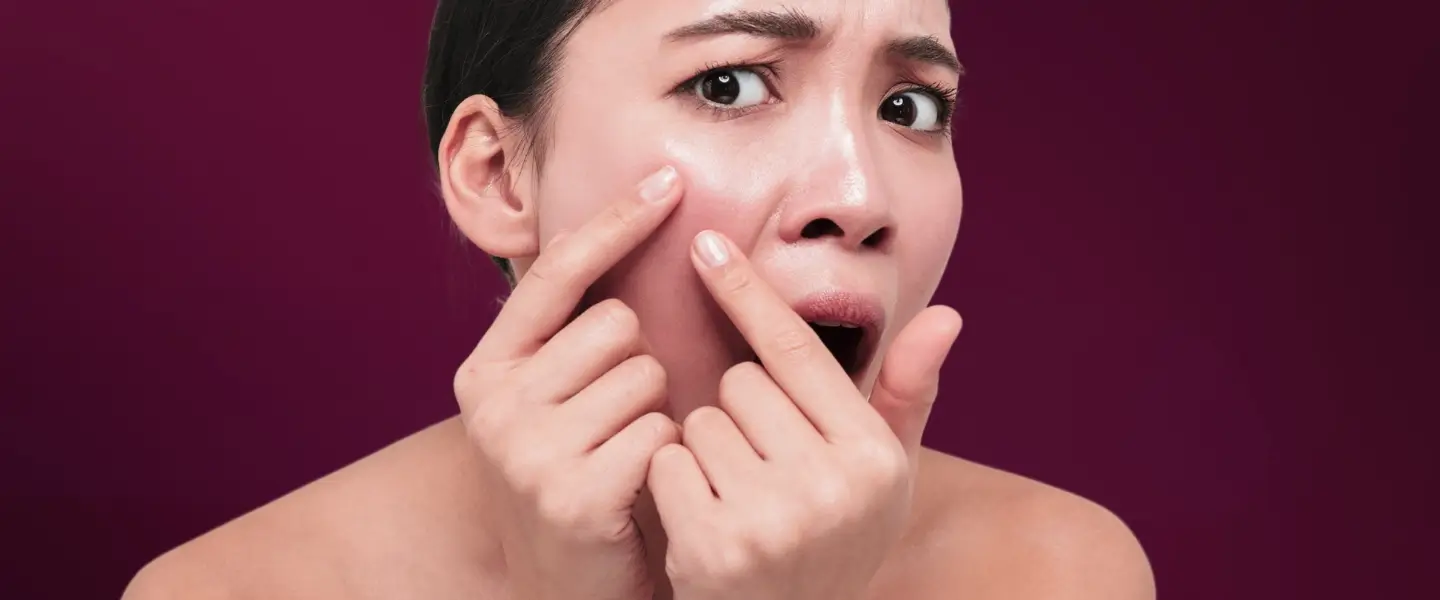 Kulit kering di wajah membuat kita kurang percaya diri