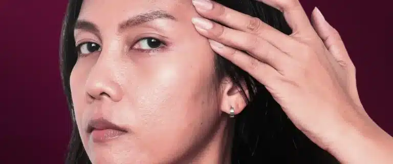 Kulit kusam bikin kamu kurang pede ? Ini rahasia untuk mengatasinya