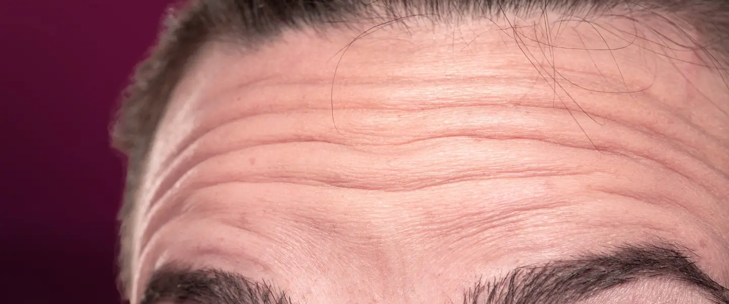 Apa penyebab penuaan dini pada wajah dan bagaimana langkah sederhana untuk mengatasinya