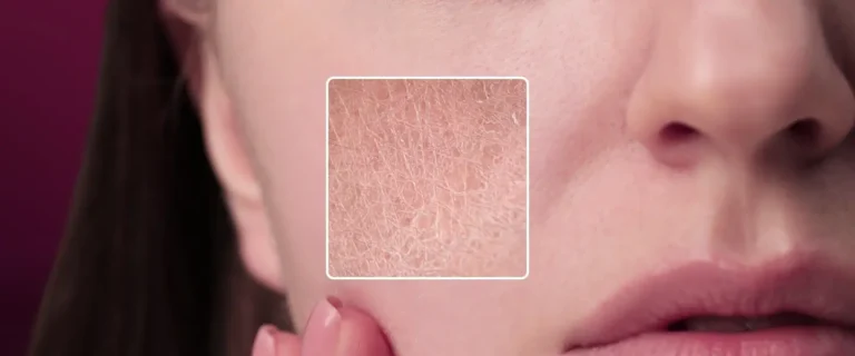 Perawatan alami untuk atasi kulit muka kusam dan kering