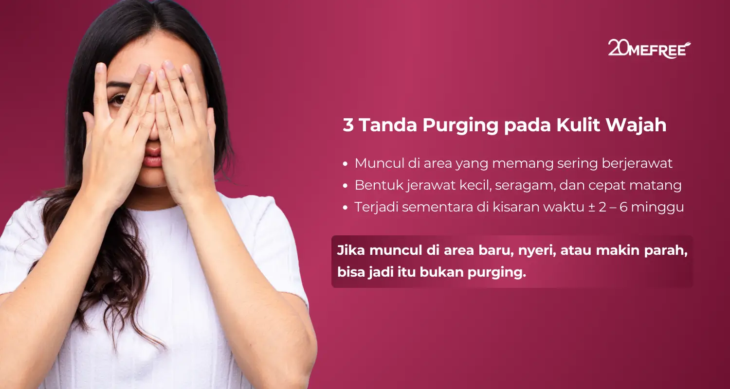 3 Tanda Purging Pada Kulit Wajah