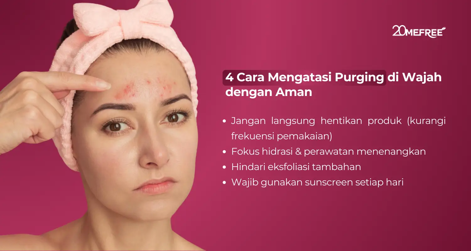 4 Cara Mengatasi Purging di Wajah dengan Aman