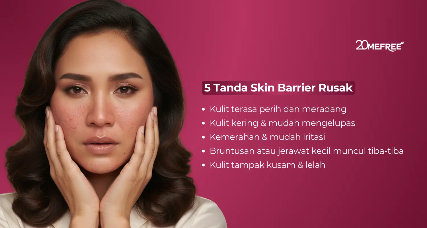 5 Tanda skin barrier rusak