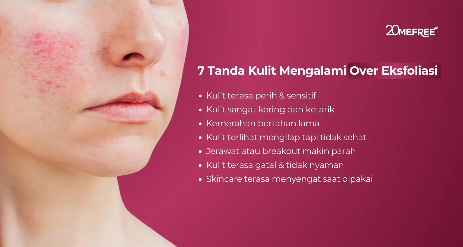 7 tanda kulit mengalami over eksfoliasi