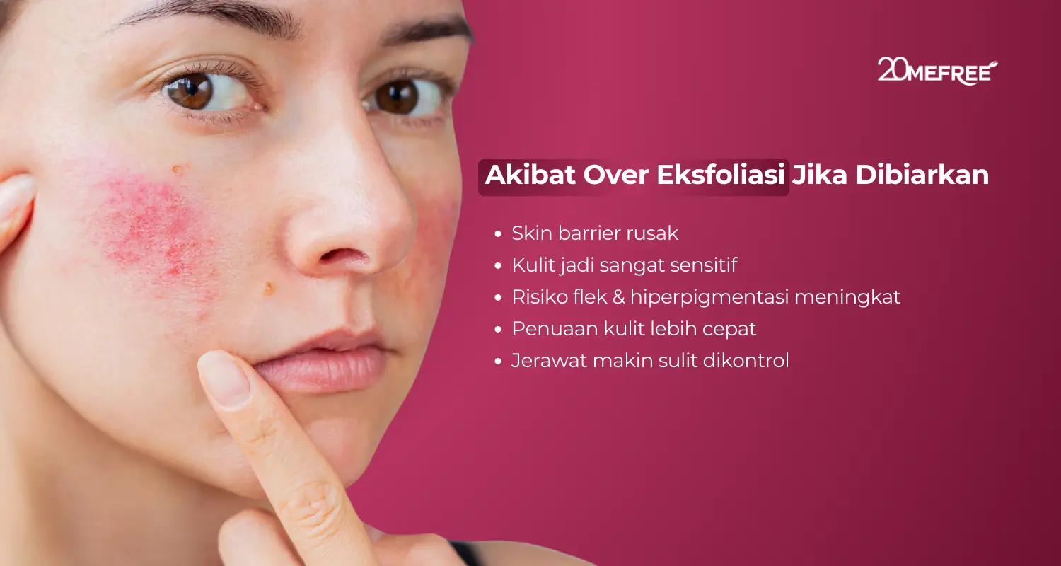 Akibat over eksfoliasi jika dibiarkan