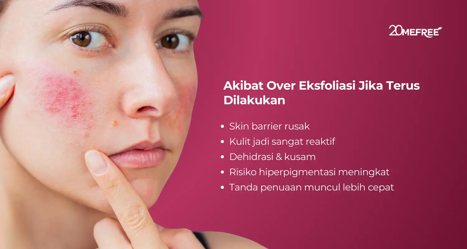 Akibat over eksfoliasi jika terus dilakukan