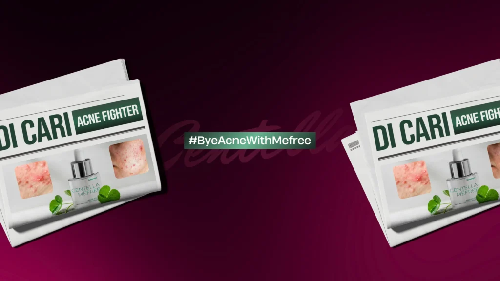 byeacnewithmefree-bg-popup