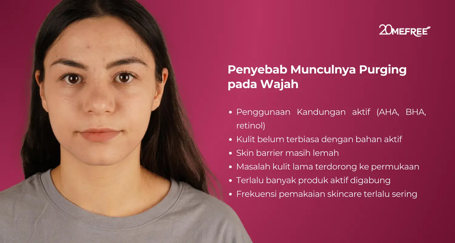 Penyebab munculnya purging pada wajah