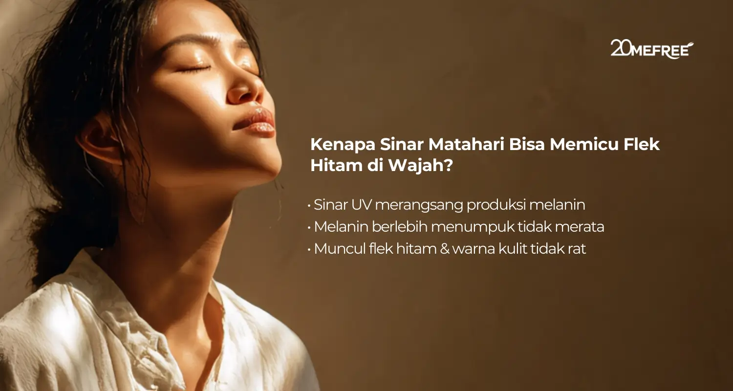 Kenapa sinar matahari bisa memicu flek hitam di wajah