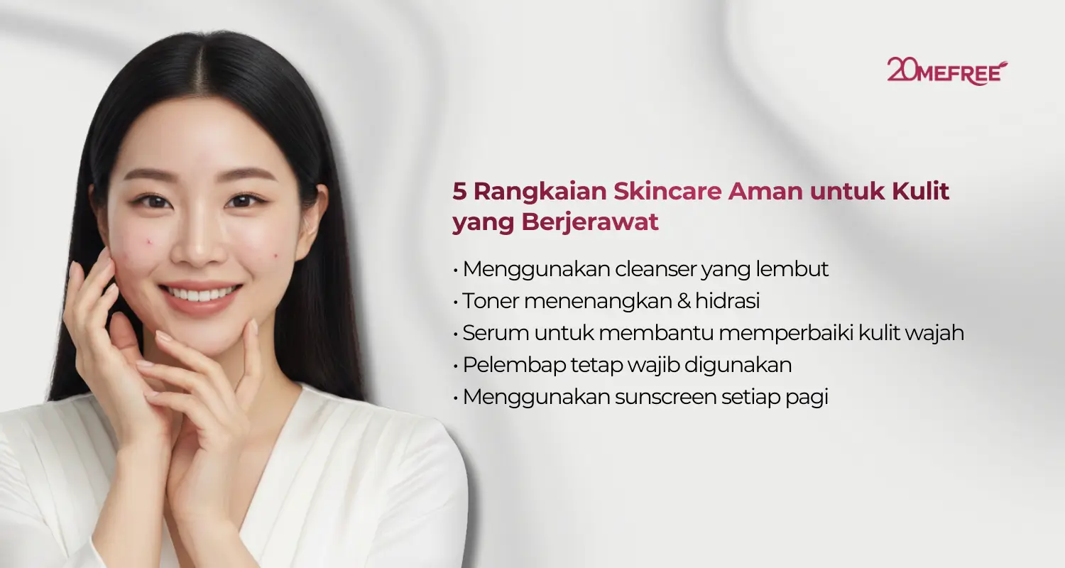 5 Rangkaian skincare aman untuk kulit yang berjerawat