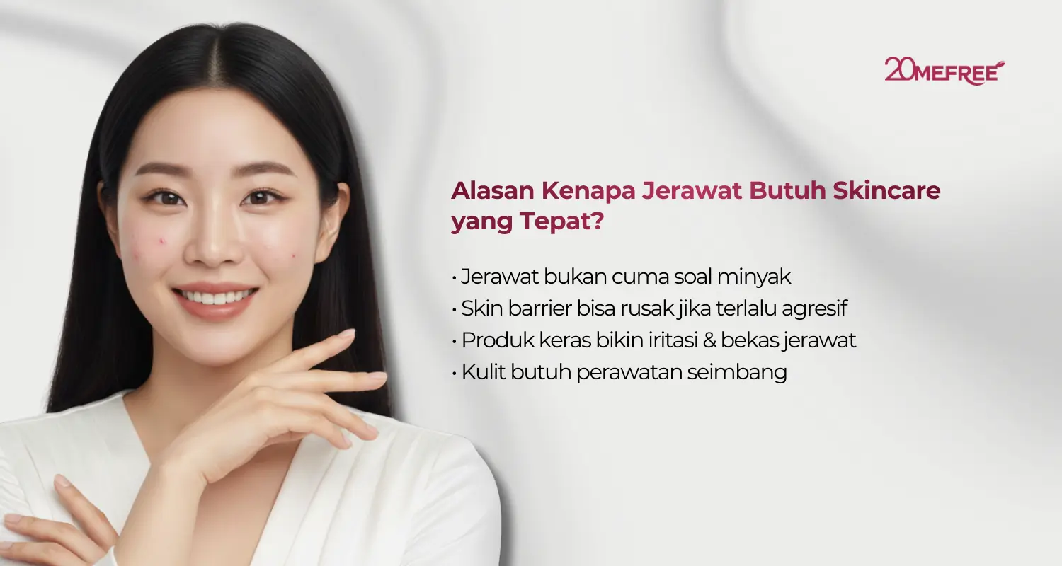 Alasan kenapa jerawat butuh skincare yang tepat